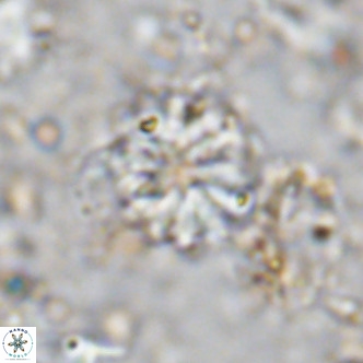 Cribrocorona echinus VR 11422