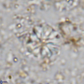 Cribrocorona echinus VR 11423