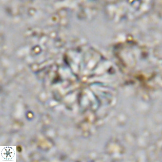 Cribrocorona echinus VR 11423