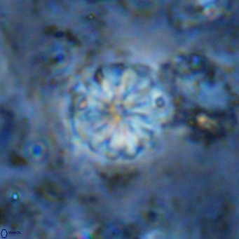 Cribrocorona echinus VR 11424