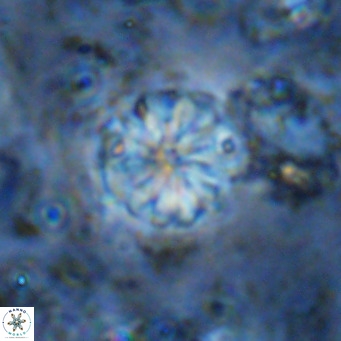 Cribrocorona echinus VR 11424