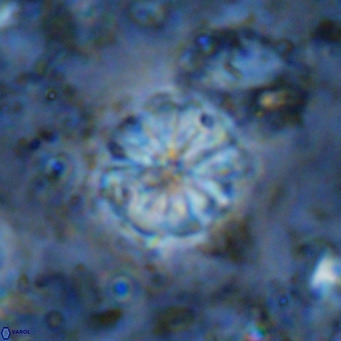 Cribrocorona echinus VR 11425
