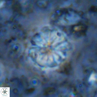 Cribrocorona echinus VR 11425
