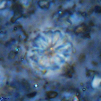Cribrocorona echinus VR 11426