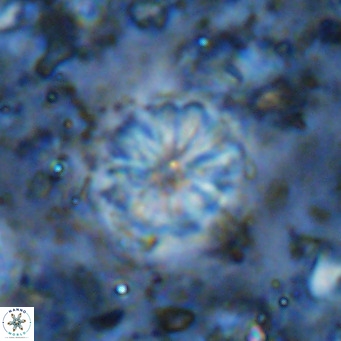 Cribrocorona echinus VR 11426