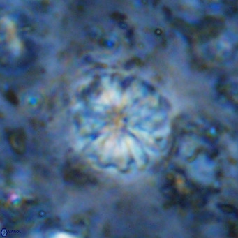 Cribrocorona echinus VR 11427