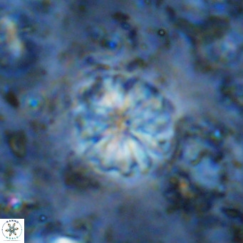Cribrocorona echinus VR 11427