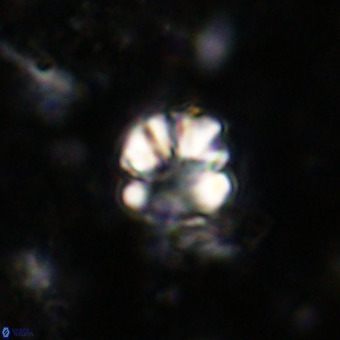 Cribrocorona echinus VR 21085