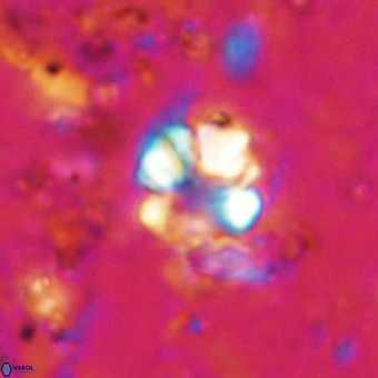 Cribrocorona echinus VR 21086