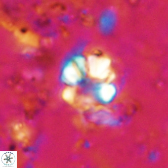 Cribrocorona echinus VR 21086