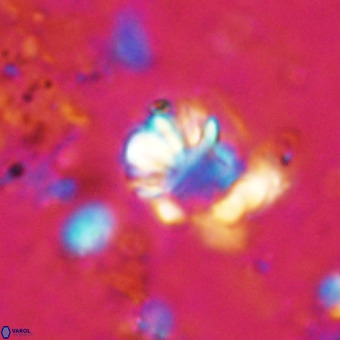 Cribrocorona echinus VR 21087