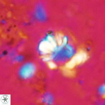 Cribrocorona echinus VR 21087