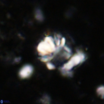 Cribrocorona echinus VR 21088