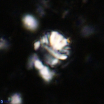 Cribrocorona echinus VR 21089