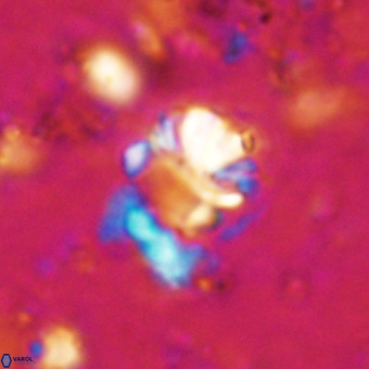 Cribrocorona echinus VR 21090
