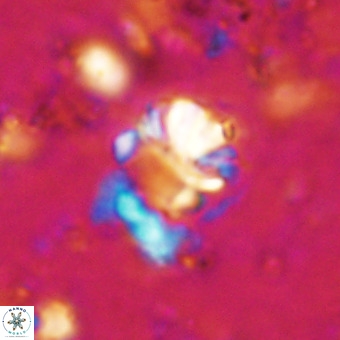 Cribrocorona echinus VR 21090