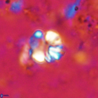 Cribrocorona echinus VR 21091