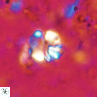 Cribrocorona echinus VR 21091