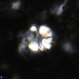 Cribrocorona echinus VR 21092
