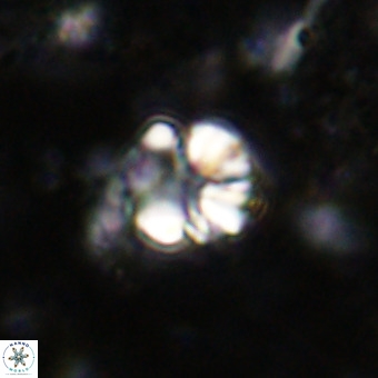 Cribrocorona echinus VR 21092