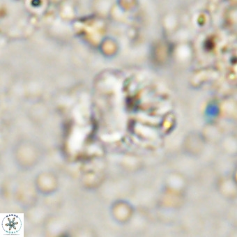 Cribrocorona echinus VR 21093