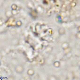 Cribrocorona echinus VR 21094