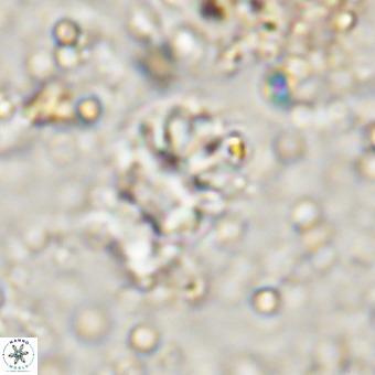 Cribrocorona echinus VR 21094
