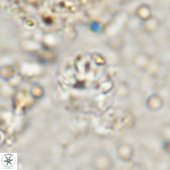 Cribrocorona echinus VR 21095
