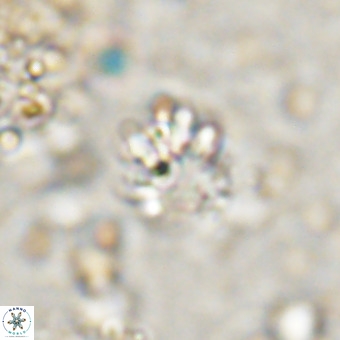 Cribrocorona echinus VR 21096