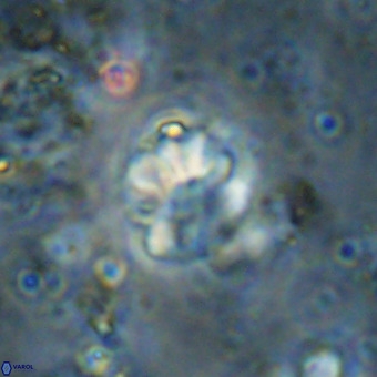 Cribrocorona echinus VR 21097