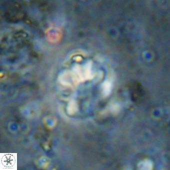 Cribrocorona echinus VR 21097