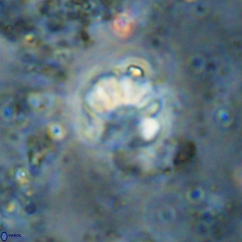 Cribrocorona echinus VR 21099