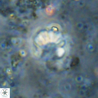 Cribrocorona echinus VR 21099