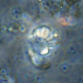 Cribrocorona echinus VR 21100