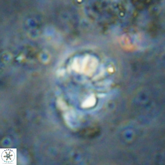 Cribrocorona echinus VR 21100
