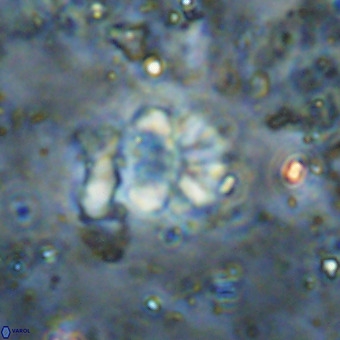 Cribrocorona echinus VR 21101