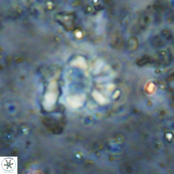 Cribrocorona echinus VR 21101