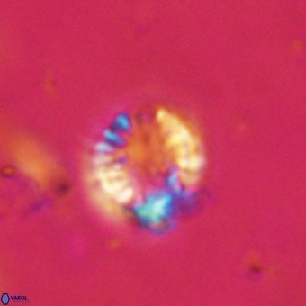 Cribrocorona echinus VR 22940