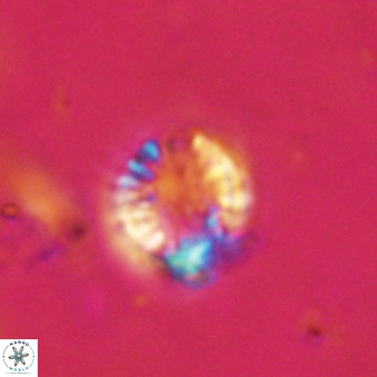 Cribrocorona echinus VR 22940