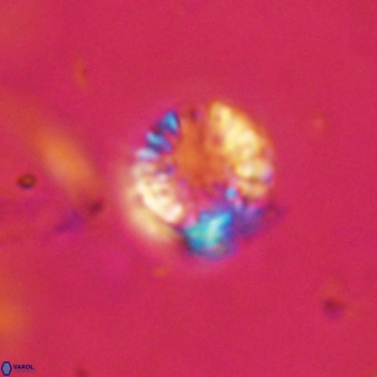 Cribrocorona echinus VR 22941