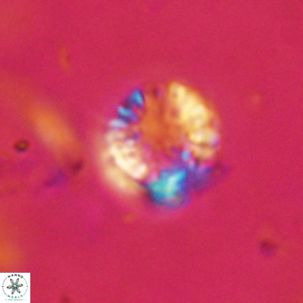 Cribrocorona echinus VR 22941