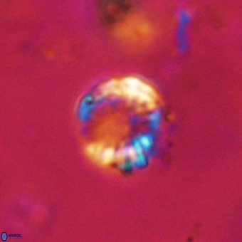 Cribrocorona echinus VR 22923