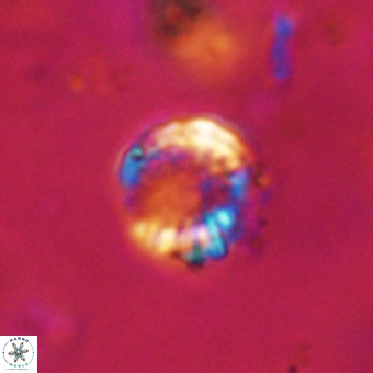 Cribrocorona echinus VR 22923