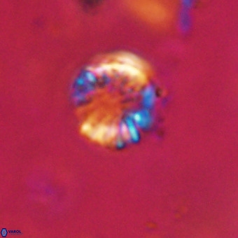 Cribrocorona echinus VR 22924