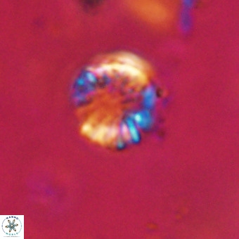 Cribrocorona echinus VR 22924