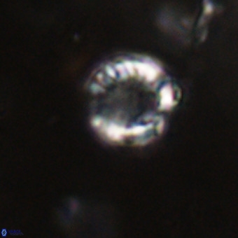 Cribrocorona echinus VR 22925