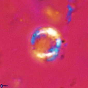 Cribrocorona echinus VR 22927