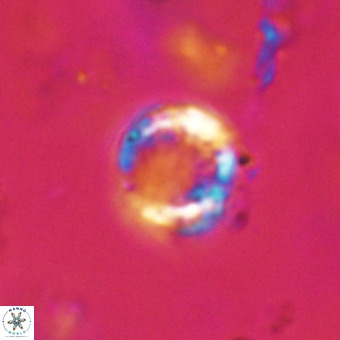 Cribrocorona echinus VR 22927