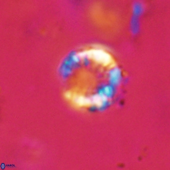 Cribrocorona echinus VR 22928