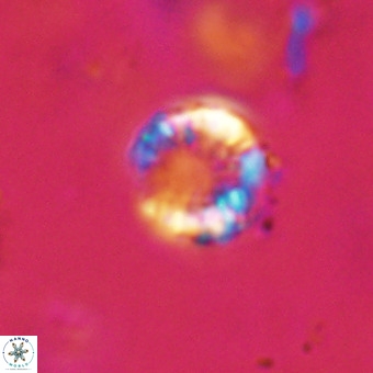 Cribrocorona echinus VR 22928